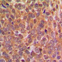 EIF2S1 Antibody (phospho-Ser51)