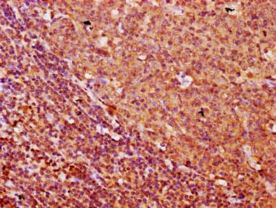 FREM1 Antibody