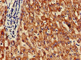 GRHPR / Glyoxylate Reductase Antibody