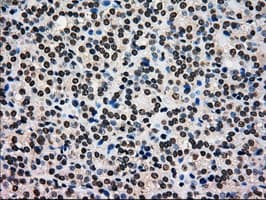 Monoclonal Mouse anti-Human GCK / Glucokinase Antibody (clone OTI3E3, IHC, IF, WB)