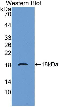 LGALS1 / Galectin 1 Antibody (aa2-135)