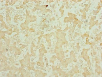 Polyclonal Rabbit anti-Human CHCHD3 Antibody (IHC, WB)