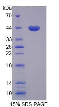 Rat GTF3A Protein (Recombinant His, N-Terminal)