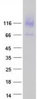Human RBBP8NL / C20orf151 Protein (Recombinant Myc-DDK (Flag))