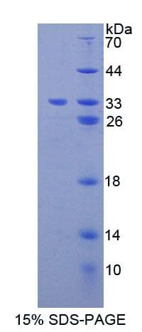 Mouse SLC20A1 Protein (Recombinant His-T7, N-terminus)