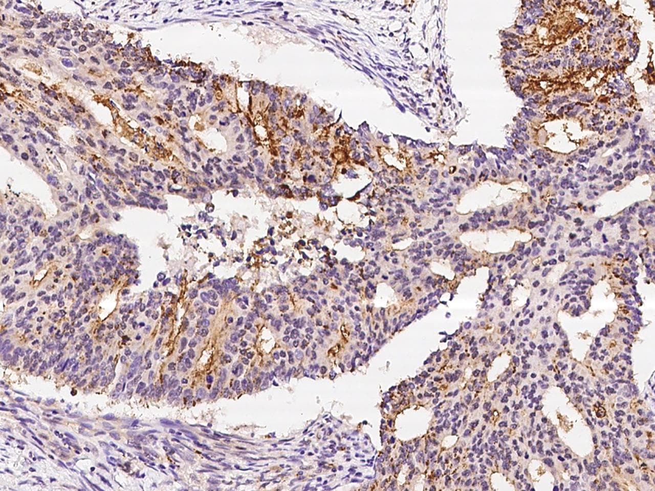 Polyclonal Rabbit anti-Human MKKS Antibody (IHC)