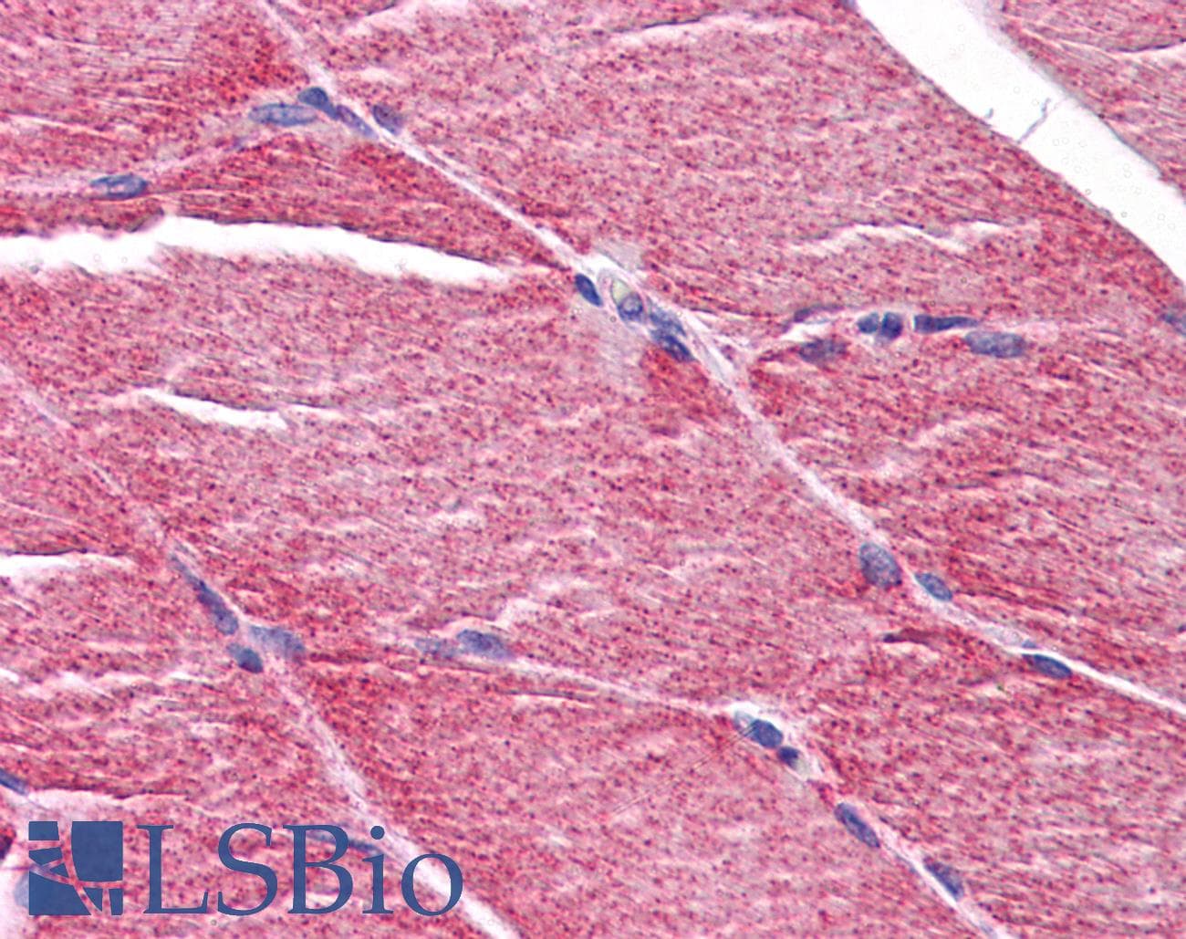 IHC-plus™ Polyclonal Rabbit anti-Human MYBPC2 Antibody (IHC, WB)