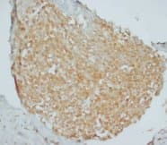 GORAB / SCYL1BP1 Antibody (Internal)