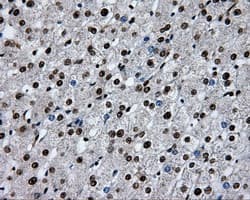 RPA2 / RFA2 / RPA34 Antibody (clone OTI9A1)