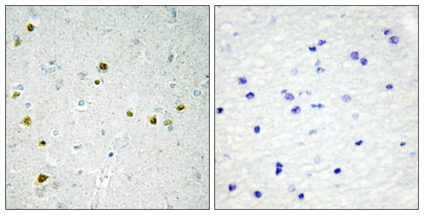 LIG4 / DNA Ligase IV Antibody (Ab-650)