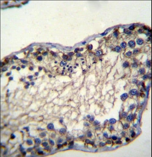 Polyclonal Rabbit anti-Human TSSK6 Antibody (aa25-54, IHC, WB)