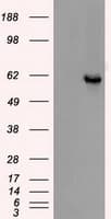 CHEK2 / CHK2 Antibody (clone OTI2H5)