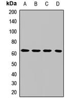 Polyclonal Rabbit anti-Human USP39 Antibody (WB)