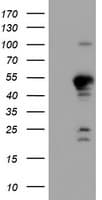 Monoclonal Mouse anti-Human PPP1R15A / GADD34 Antibody (clone OTI4F1, IHC, IF, WB)