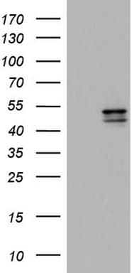 CSNK1E / CK1 Epsilon Antibody (aa153-416, clone OTI2B3)