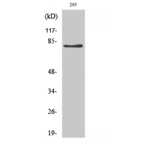 ADD2 Antibody (440-520 aa, Internal)