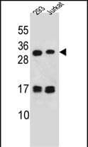 Polyclonal Rabbit anti-Human LOC339742 Antibody (aa 147-176, C-term, IHC, WB)