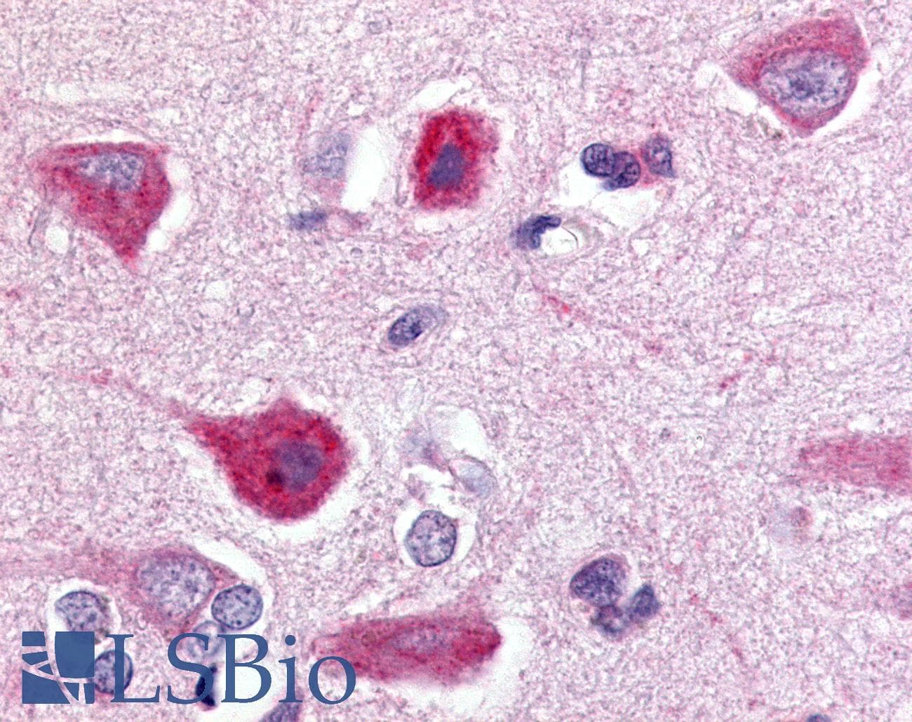IHC-plus™ Polyclonal Rabbit anti-Human C5AR2 / GPR77 / C5L2 Antibody (C-Terminus, IHC)