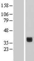 CLEC10A / CD301 Protein (Over-Expression Lysate Myc-DDK (Flag))