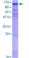 Human MAST205 / MAST2 Protein (Recombinant GST)