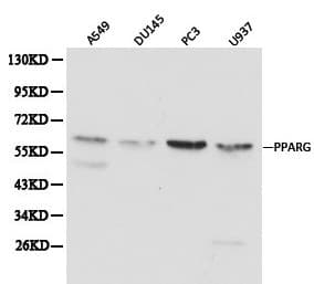 Polyclonal Rabbit anti-Human PPARG / PPAR Gamma Antibody (IHC, WB)