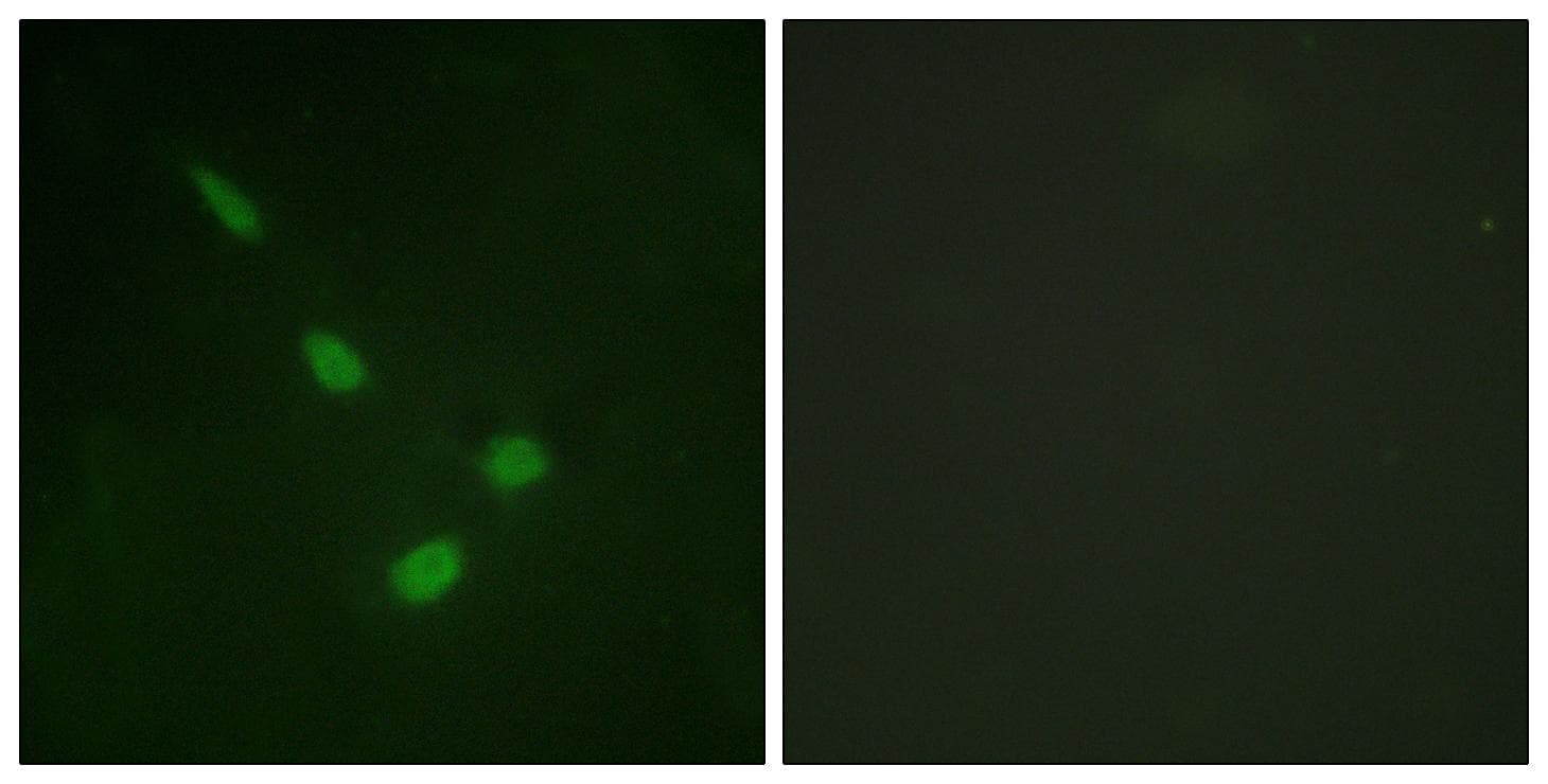 MAPK15 / ERK7 Antibody (p175/177)