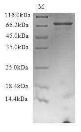 Human FBXW7 / FBW7 Protein (Recombinant 6His, N-terminus)