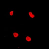 RAD54L2 Antibody