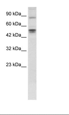 Polyclonal Rabbit anti-Human MDM4 / MDMX Antibody (aa130-179, IHC, WB)