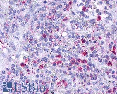 PathPlus™ Leukotriene B4 Receptor / BLT1 Antibody (Cytoplasmic Domain)