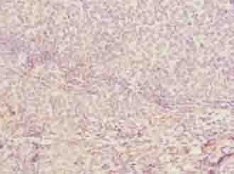 Polyclonal Rabbit anti-Human CDADC1 Antibody (IHC)
