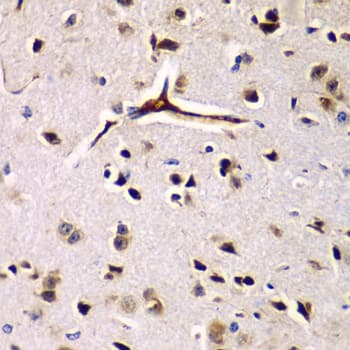 GCN2 Antibody