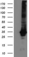 GSTT2 Antibody (clone OTI6C4)