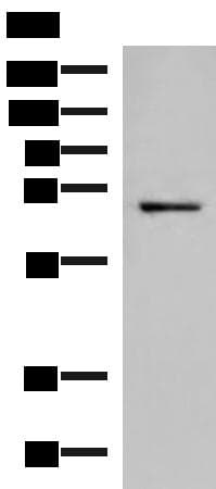 Polyclonal Rabbit anti-Human GSPT2 Antibody (IHC, WB)