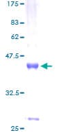 Human WFDC5 / PRG5 Protein (Recombinant GST)