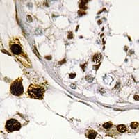 UBE1L2 / UBE1L2 Antibody