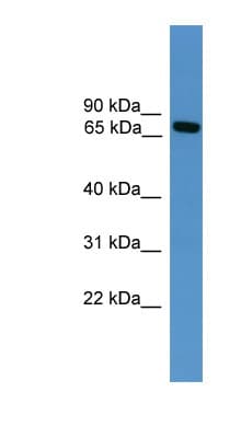 MASP2 / MASP-2 Antibody (aa201-250)
