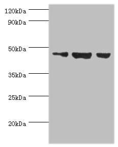 Polyclonal Rabbit anti-Human BAF53B / ACTL6B Antibody (aa1-280, IHC, WB)