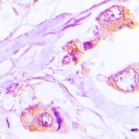 Harmonin / USH1C Antibody