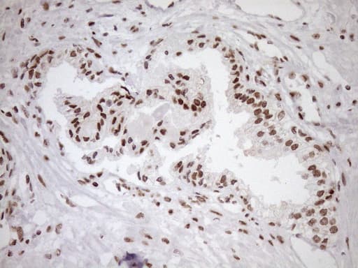 EXOSC1 / CSL4 Antibody (clone OTI1H9, Carrier-free)