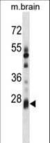 KCTD6 Antibody (aa75-103)