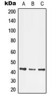 LMX1B Antibody (Internal)
