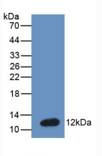 NPPB / BNP Antibody (Cy3)