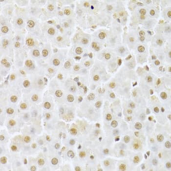 Polyclonal Rabbit anti-Human CDK4 Antibody (IHC, IF, WB)