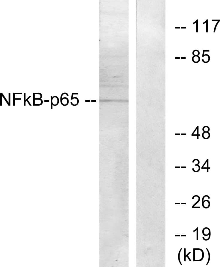 RELA / NFKB p65 Antibody (aa221-270)