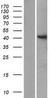 Human ST8SIA6 Protein (Over-Expression Lysate Myc-DDK (Flag))
