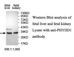 PHYHD1 Antibody (aa33-287)