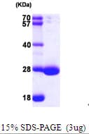 Human RAP2 Protein (Recombinant His)