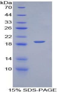 Mouse PECAM-1 / CD31 Protein (Recombinant His)