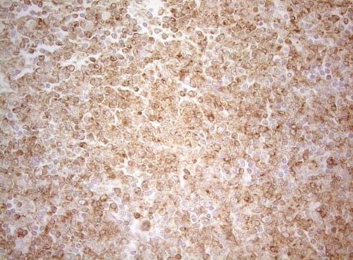 ALOX5 / 5-LOX Antibody (aa18-364, clone OTI2C5)